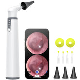 AnyScope otoscope gyroscope: direction stable pour une inspection précise du conduit auditif.