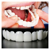 Treayes kit-blanchiment rapide : sourire lumineux à domicile et pratique.