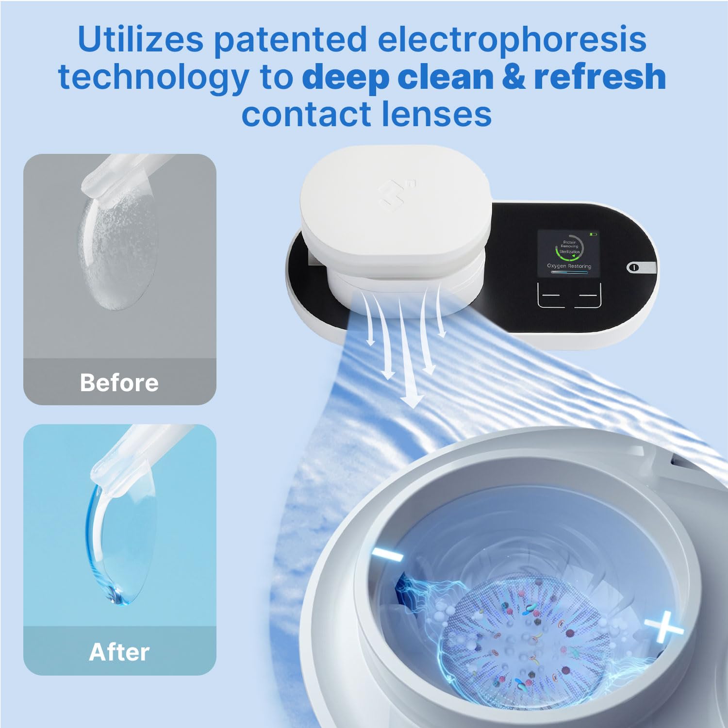 Technologie d'électrophorèse rétablit l'oxygénation pour des lentilles plus confortables