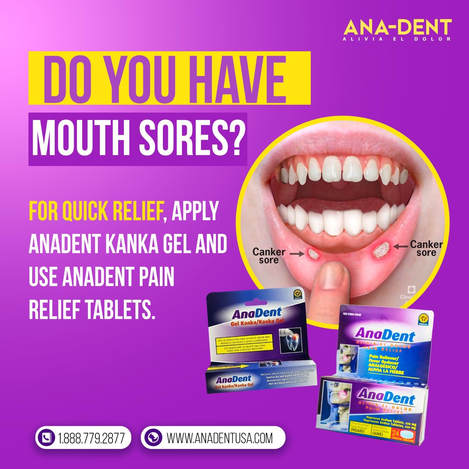 Anadent Gel Dentaire pour aphtes et irritations buccales douloureuses.