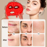 ANGAUSS thérapie lumineuse rouge 630 nm pour le visage, soutien potentiel à l'éclat.