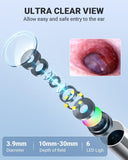 Otoscope Anykit capot de protection réglable assurant une utilisation sécurisée.