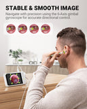 Otoscope Anykit éclairage 6 DEL pour voir parfaitement le conduit auditif.