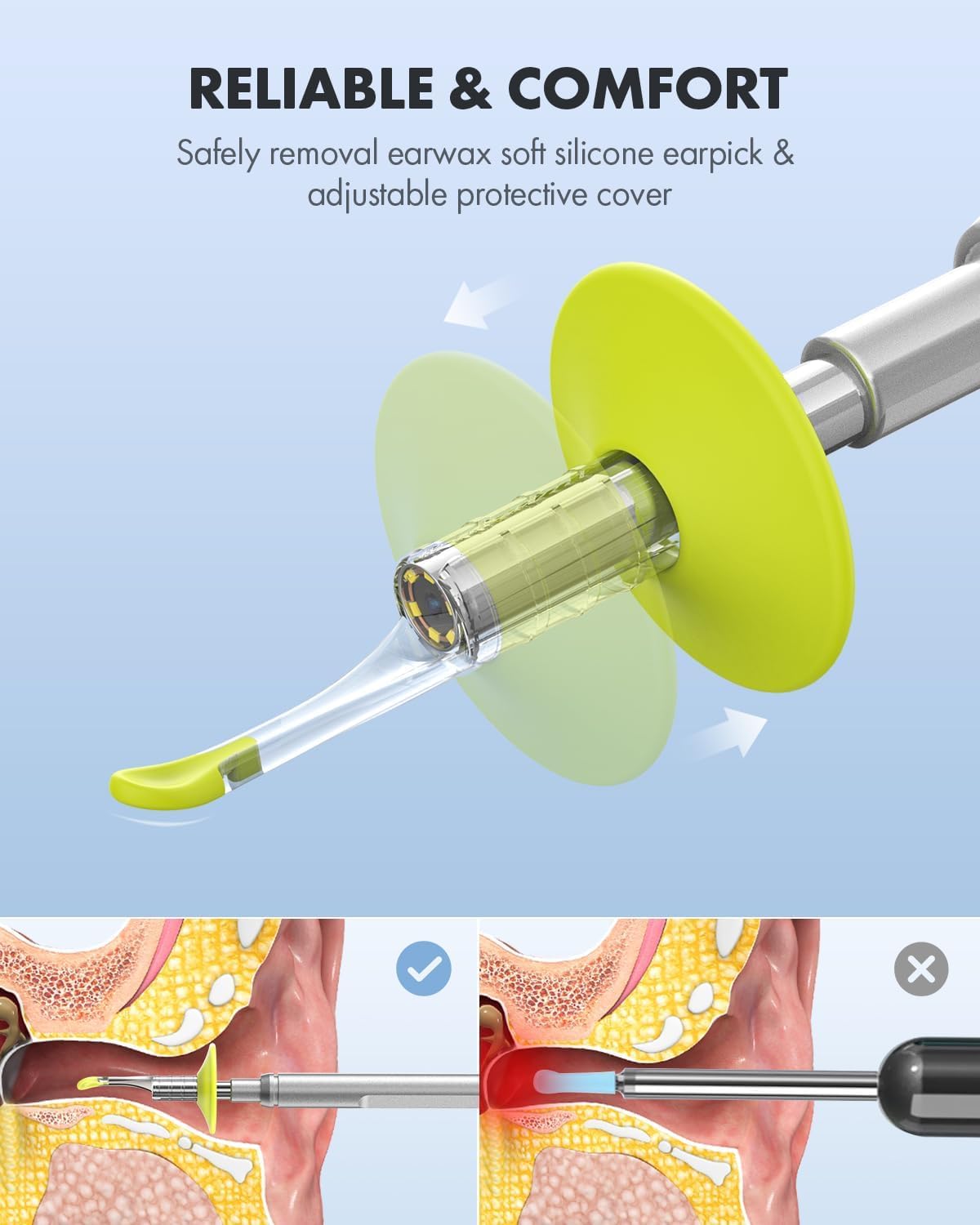Otoscope Anykit permet l’enregistrement photo et vidéo.