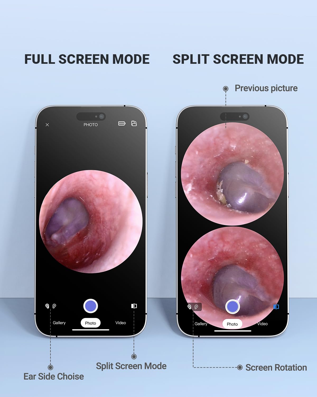 AnyScope permet l'envoi d'images au médecin pour consultation rapide.
