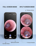 AnyScope permet l'envoi d'images au médecin pour consultation rapide.
