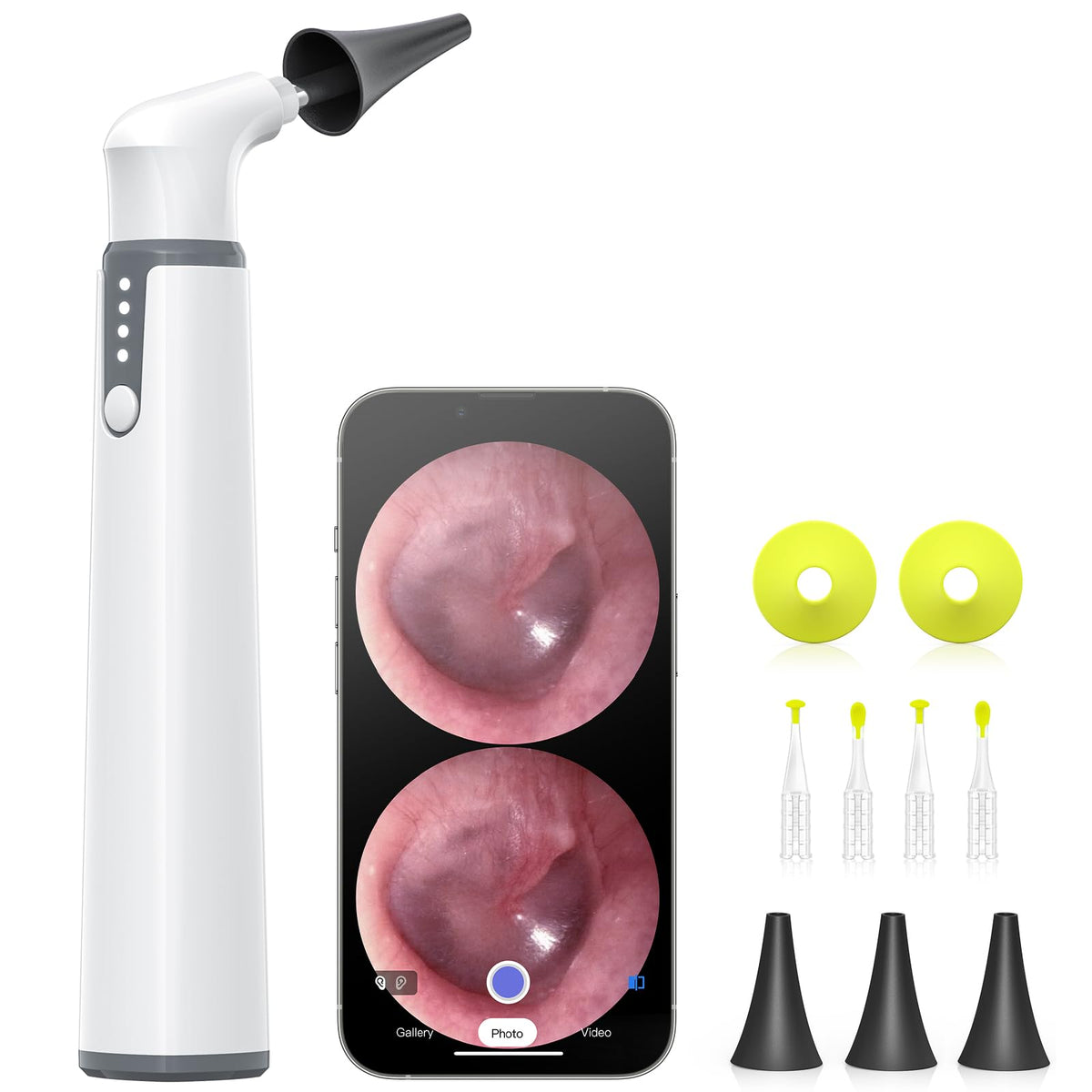 AnyScope otoscope gyroscope: direction stable pour une inspection précise du conduit auditif.