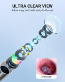 AnyScope otoscope mode vue double: comparer des images anciennes et actuelles.