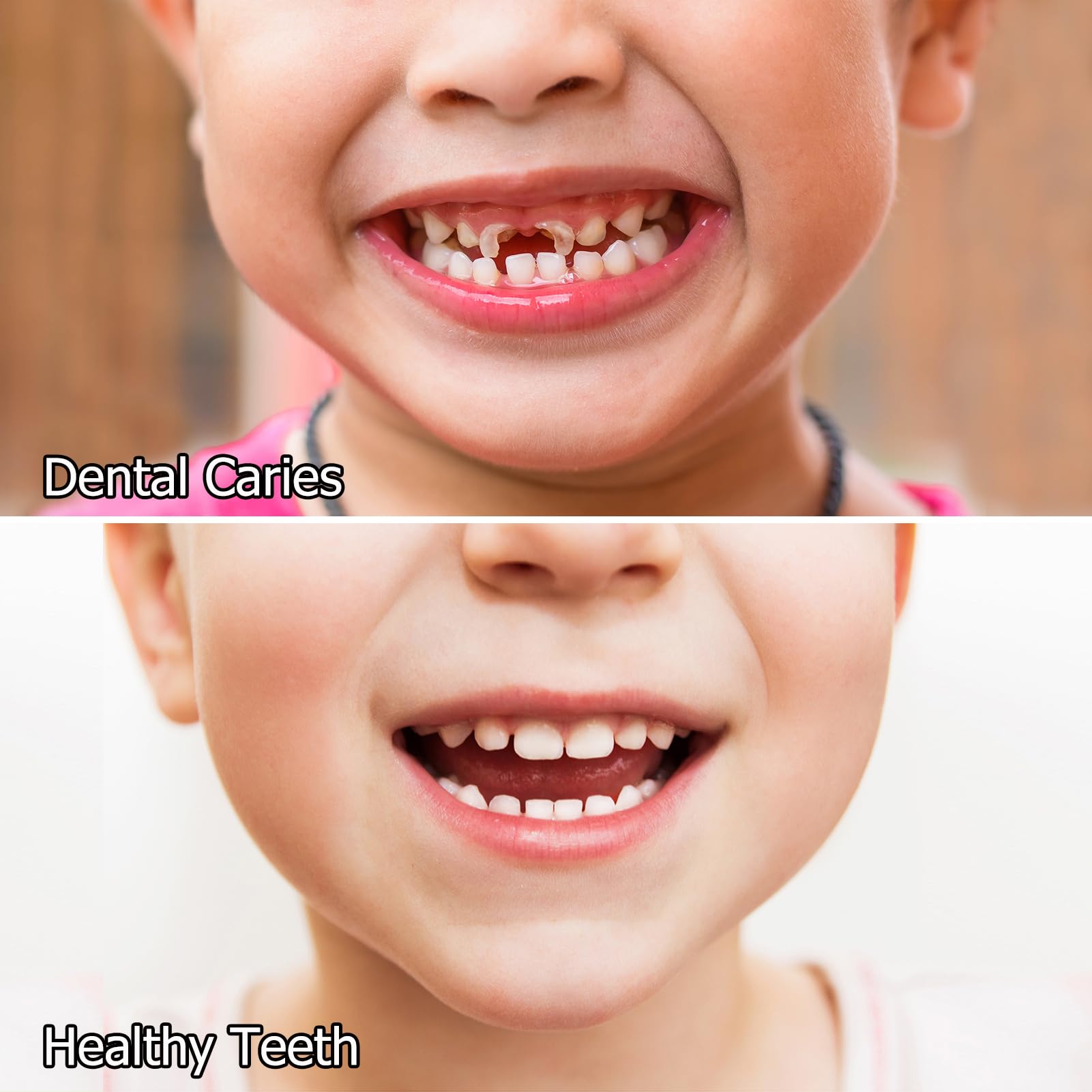 AOAO Kids Oral Spray — spray doux pour apaiser les enfants après le repas.