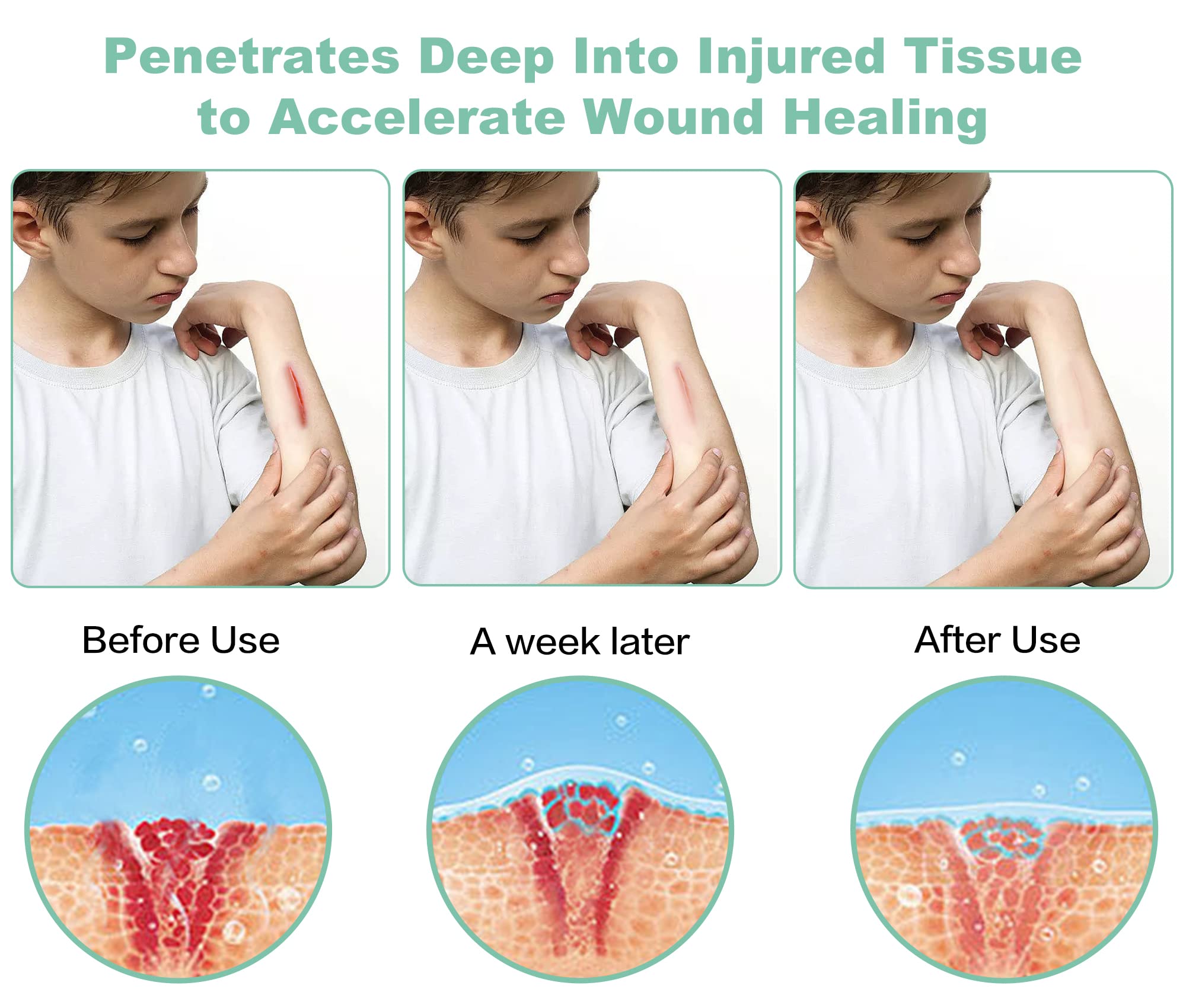 Aswaysun appareil destiné au genou, compact et facile à utiliser pour les articulations.