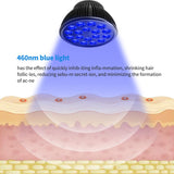 Ampoule luminothérapie bleue Aumtrly pour le corps, couverture étendue et efficace.