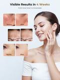 Utilisation à domicile et en voyage avec le masque Aurphany noir et compact