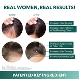 Ingrédients clés Balmbare Revive, vitamine C liposomale, soutient les cheveux.