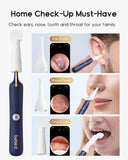 BEBIRD Earsight Plus endoscope maison pour partager des vidéos avec votre médecin.