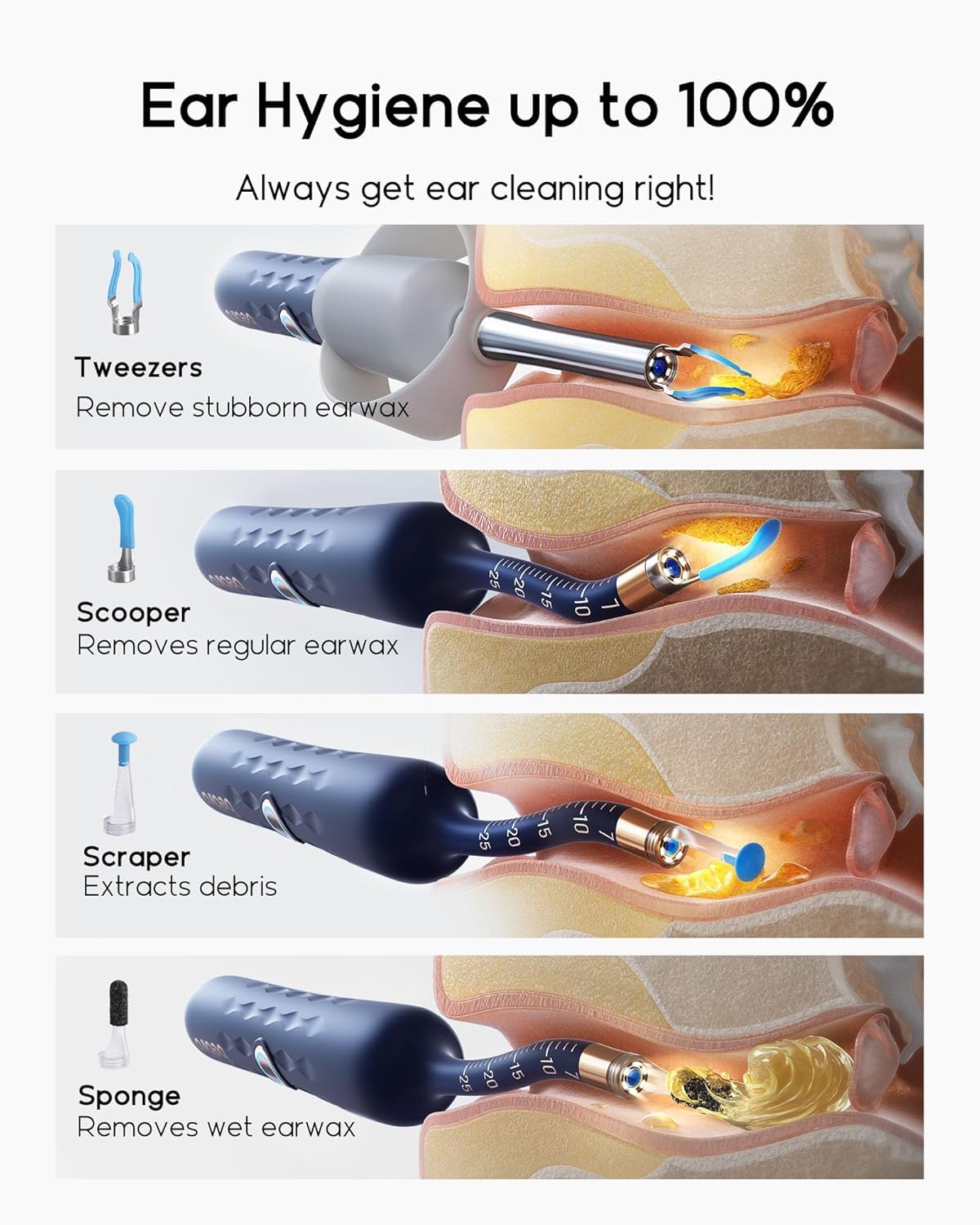 BEBIRD Earsight Plus outil d’inspection lumineux pour vérifier les oreilles en sécurité.