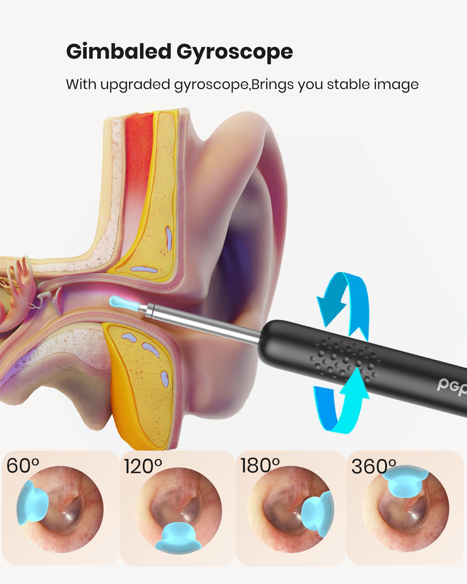 BEBIRD R1 kit d’observation oreille nez gorge pour usage domestique