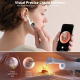 BEBIRD R1 Ultra, examen oreille a domicile avec visualisation en temps reel.