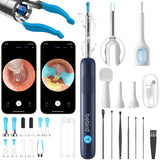 BEBIRD R1 Ultra: otoscope et lentille 10 MP, vision nette pour l’inspection