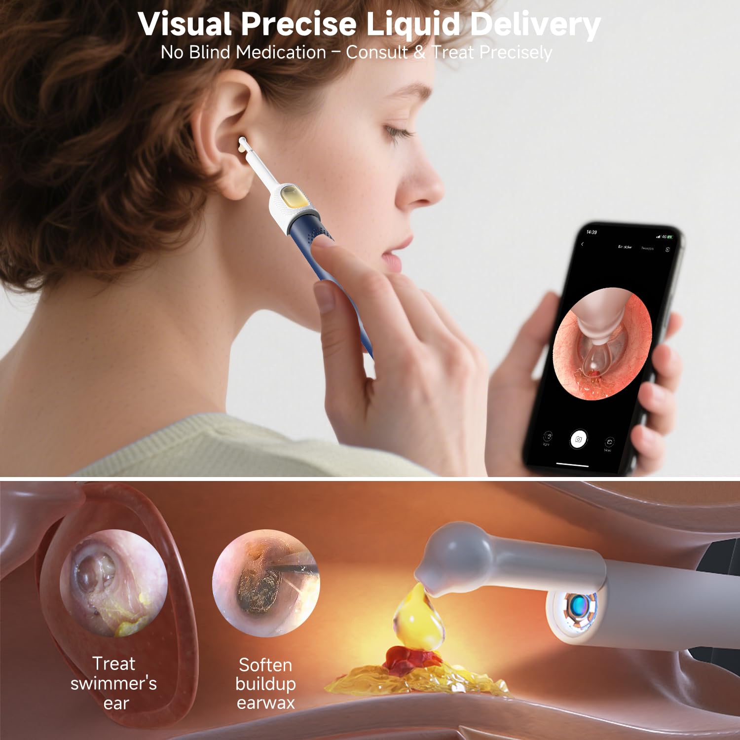BEBIRD R1 Ultra: pince-oreille pour une manipulation douce