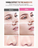 Masque BETNEP avec masque pour les yeux inclus pour le confort.