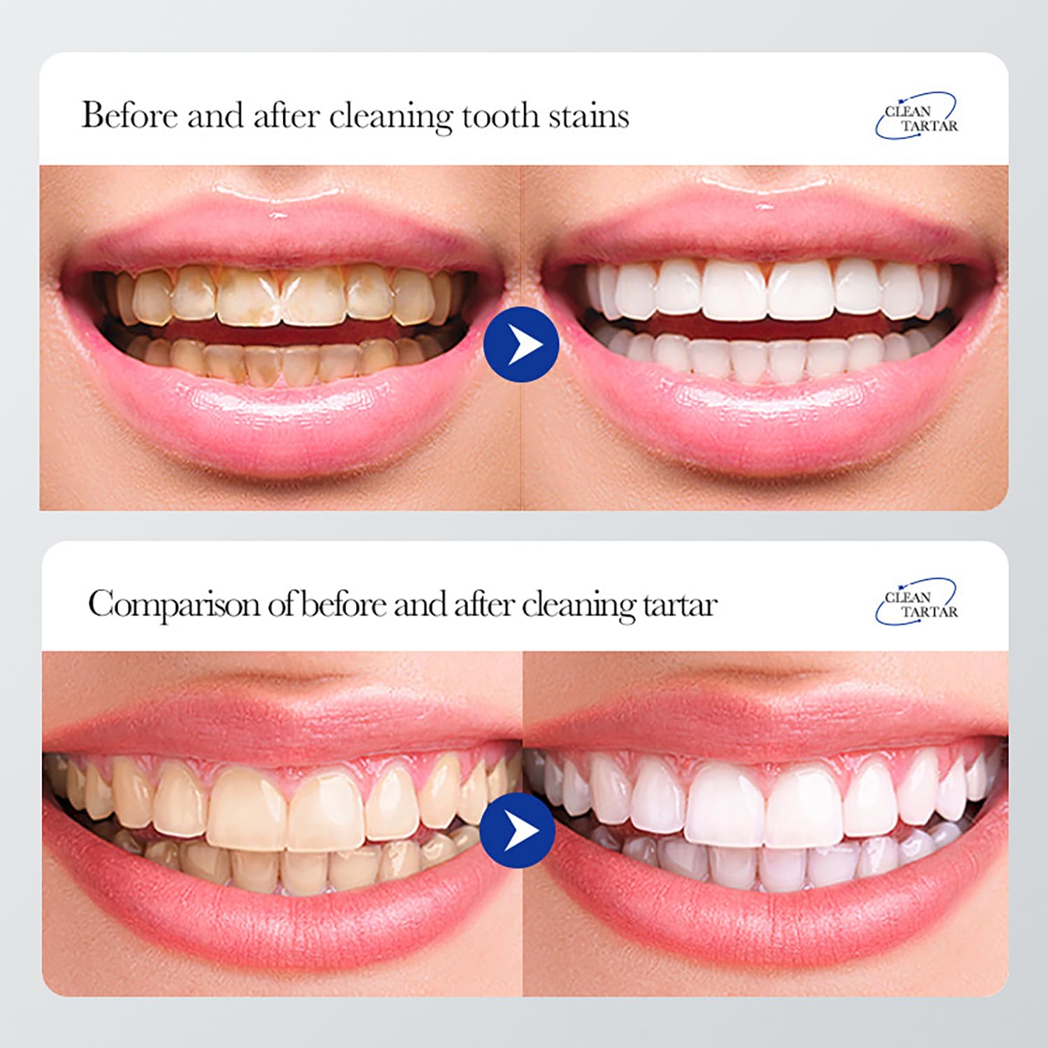 BIOAQUA dentifrice protection gencives et fraîcheur durable.