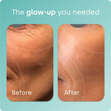 Biosil: génération de collagène active et protection des fibres.