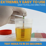 BLENSTCS ensemble paramètres urinaires pour une vue d ensemble