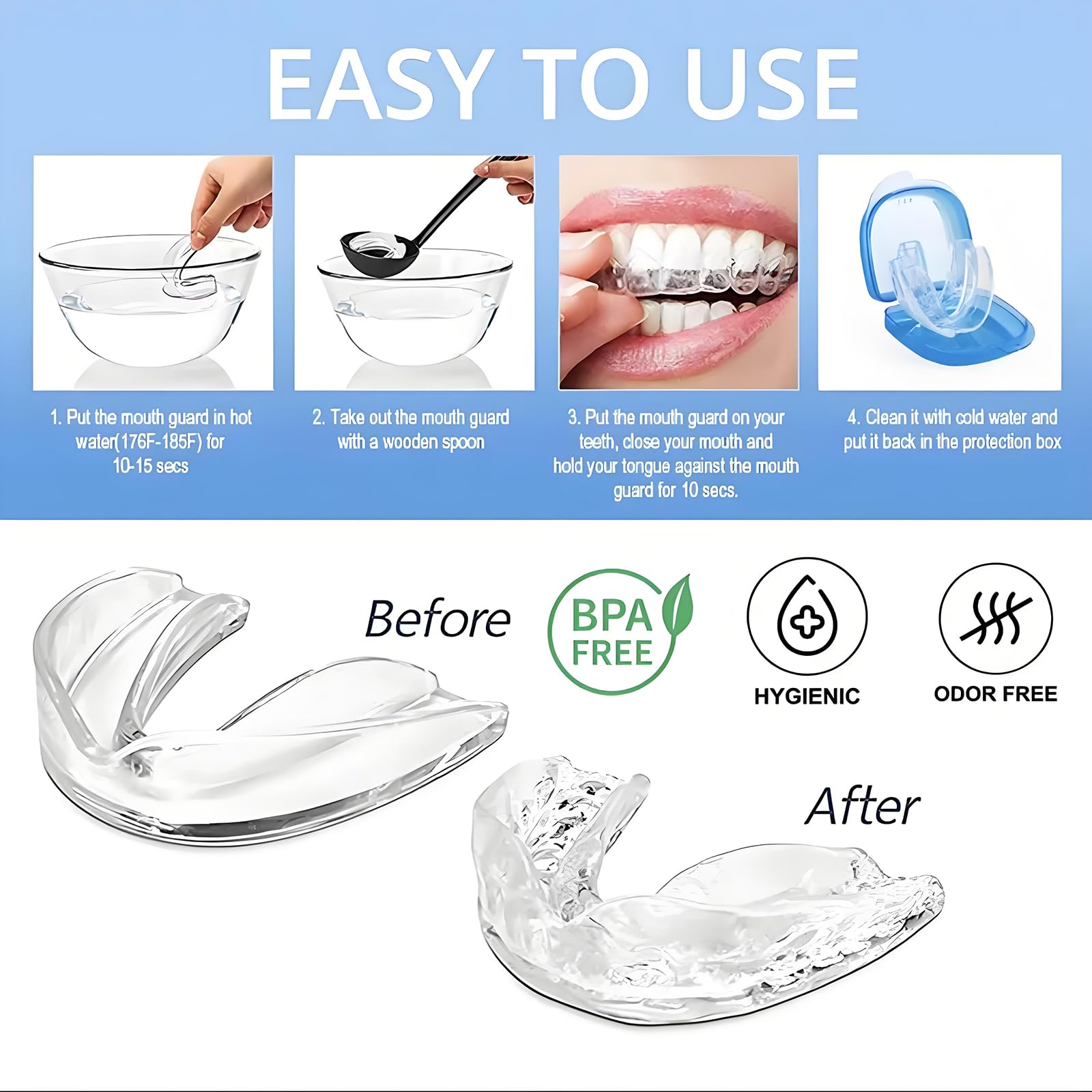 buluoushen garde-dents nuit ajustement rapide pour un confort personnalisé.