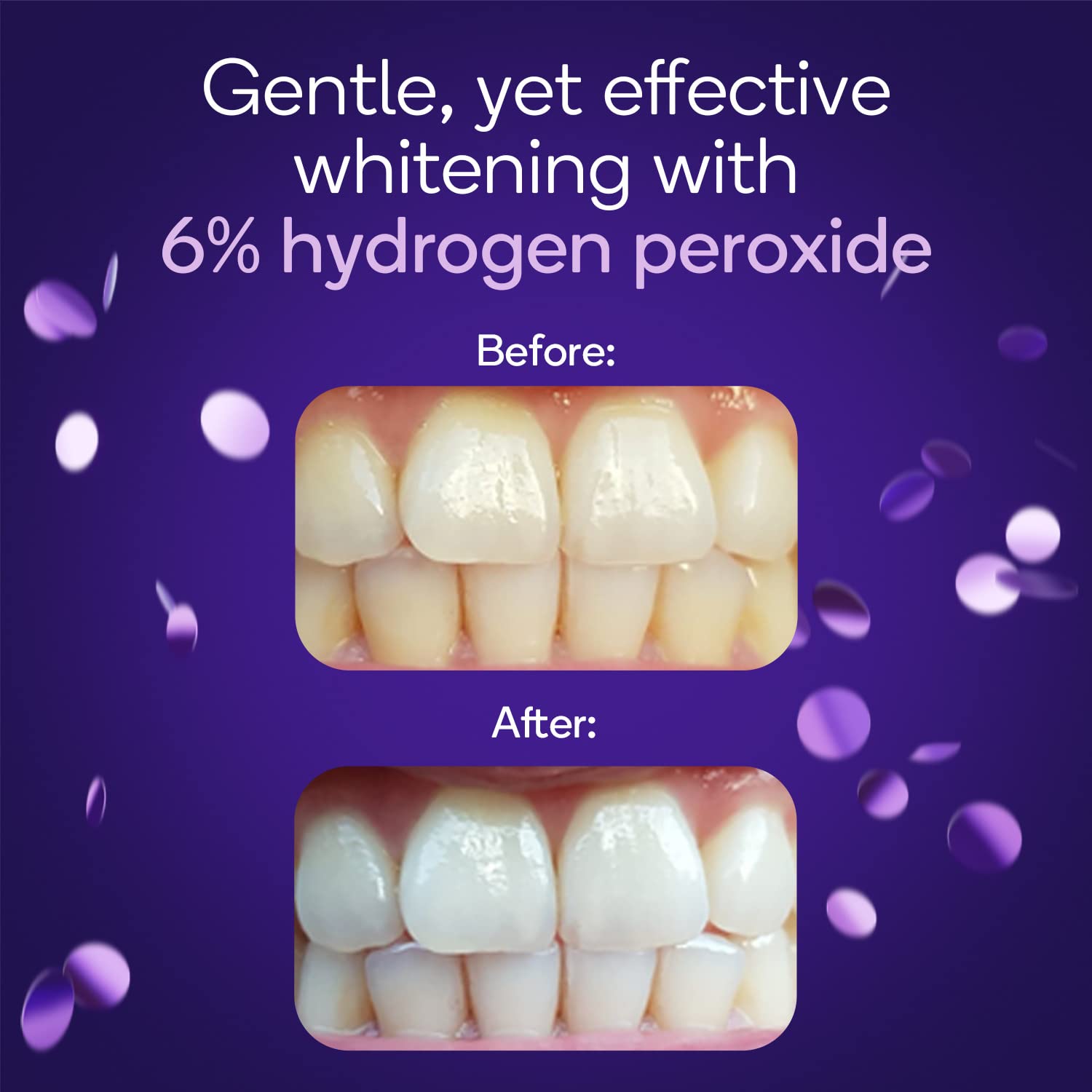 Burst application bandes-blanchiment-dents-sensibles-menthe: placement facile pour un sourire uniforme.
