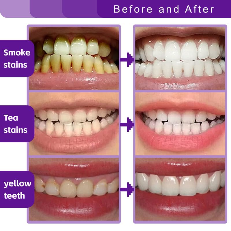 BYMOLIA dentifrice utilisation quotidienne pour adultes et enfants