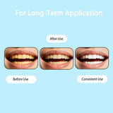 BYXE Liquide Armure Dentaire: application sur les dents pour un renforcement éventuel de l’émail