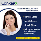 Canker-X Rincinol – sensation douce et sans brûlure.