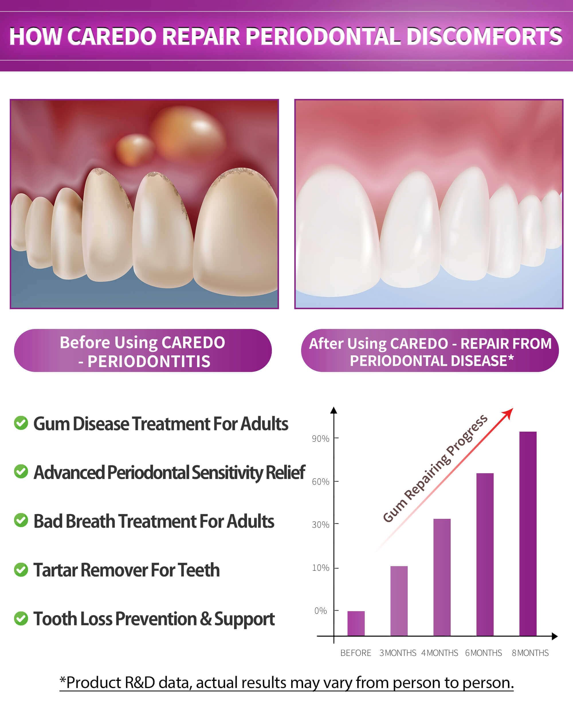 CAREDO dentifrice gencives inflammées: apaise l'inflammation et la douleur.