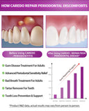 CAREDO dentifrice gencives inflammées: apaise l'inflammation et la douleur.