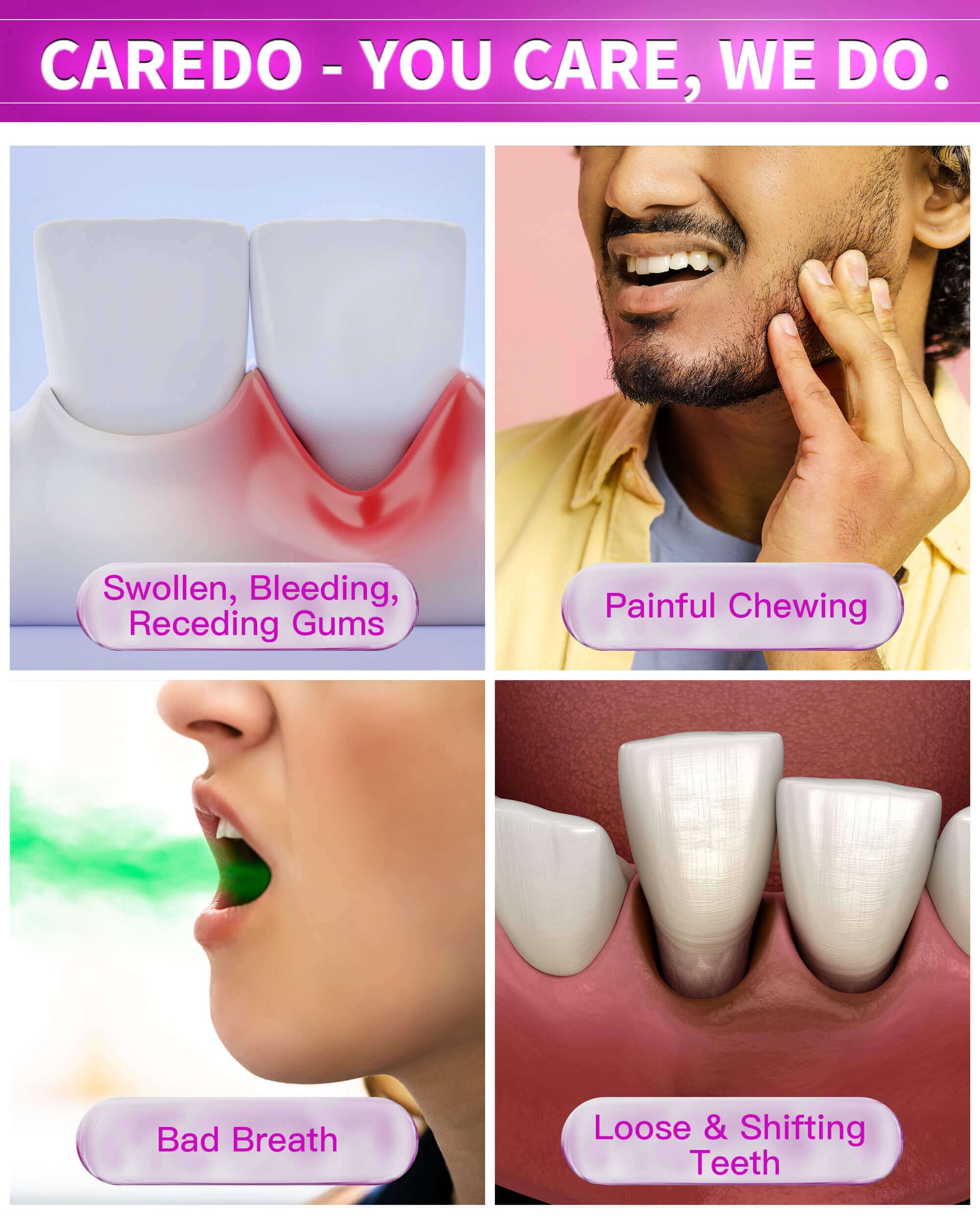 CAREDO dentifrice plaque dentaires: réduit plaque et tartre pour gencives saines.