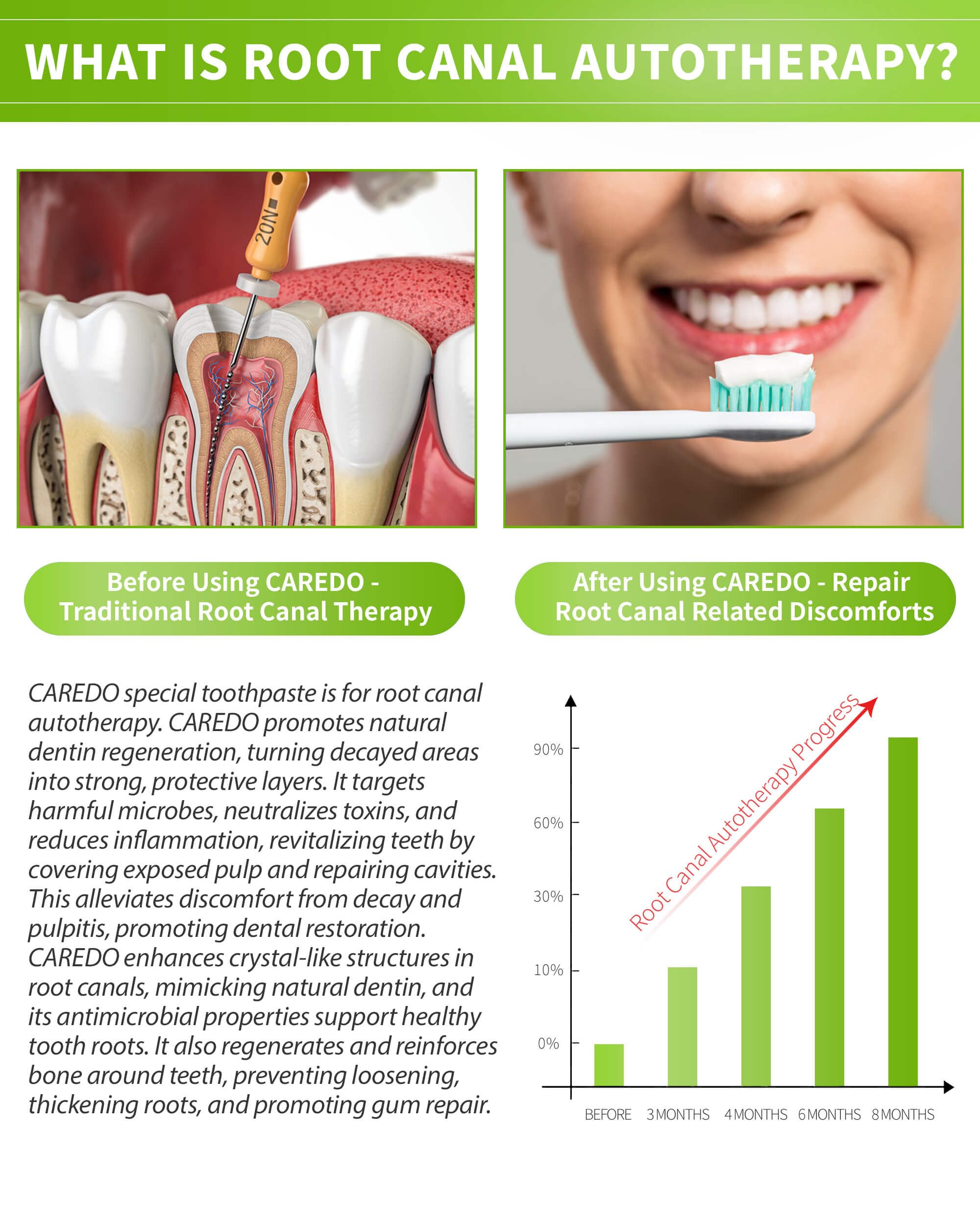 CAREDO dentifrice réparation des gencives — application facile et soin ciblé des surfaces dentaires.