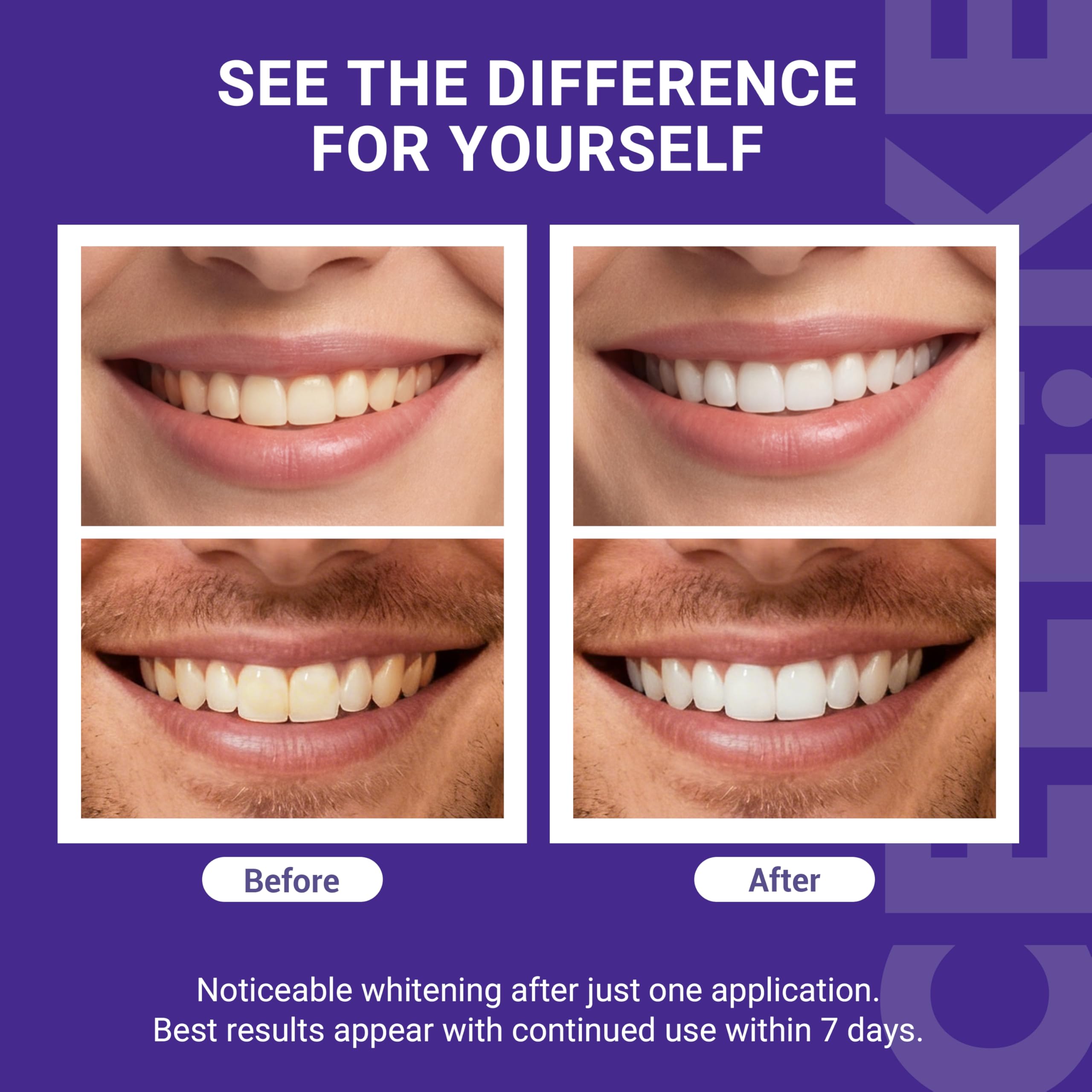 CEELIKE sourire-brillant émerge après utilisation et est visible rapidement.