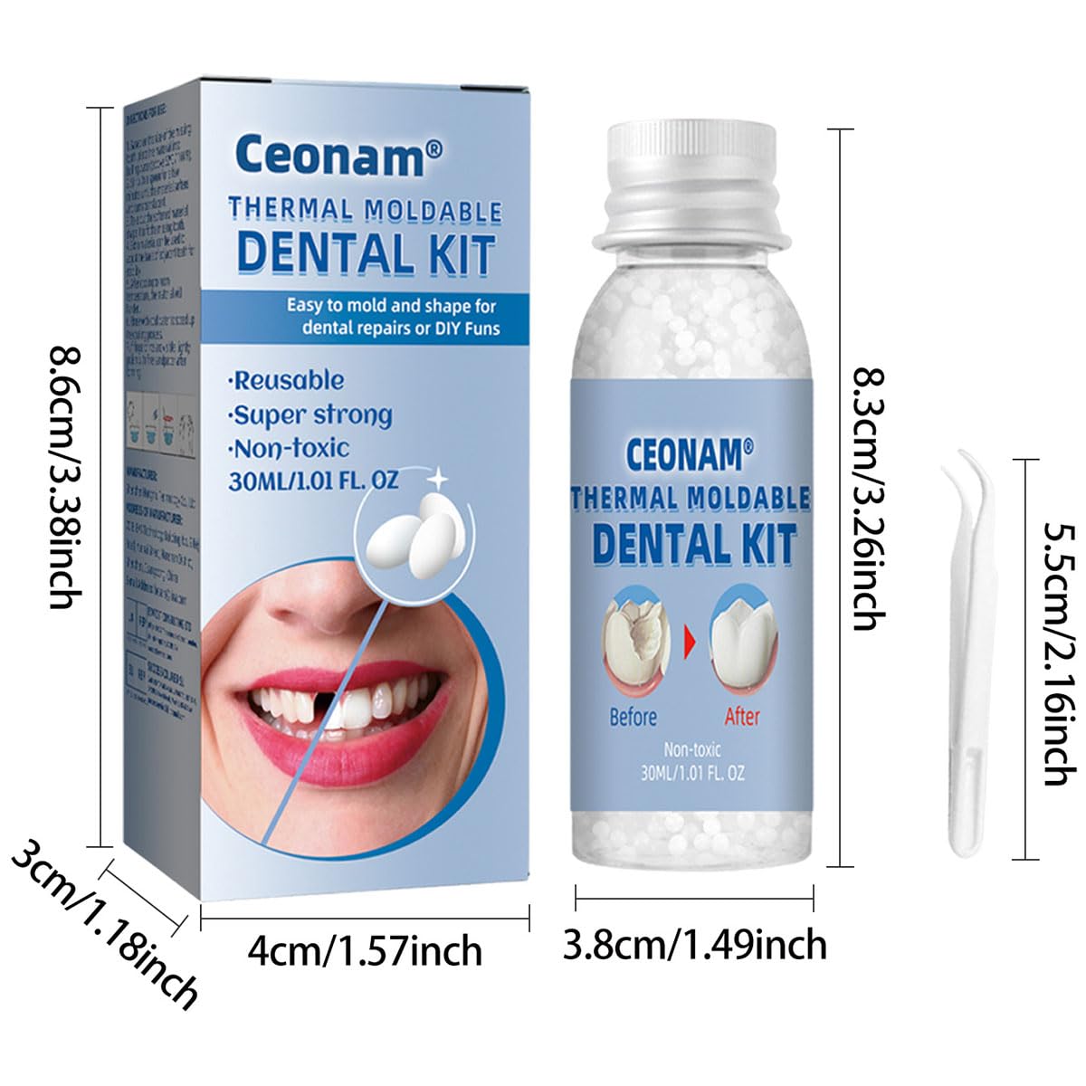 Ceonam kit-confort-naturel-dent : adaption précise et naturelle pour un port discret.