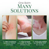 Chamuel Baume apaisement irritations: convient pour irritations mineures.