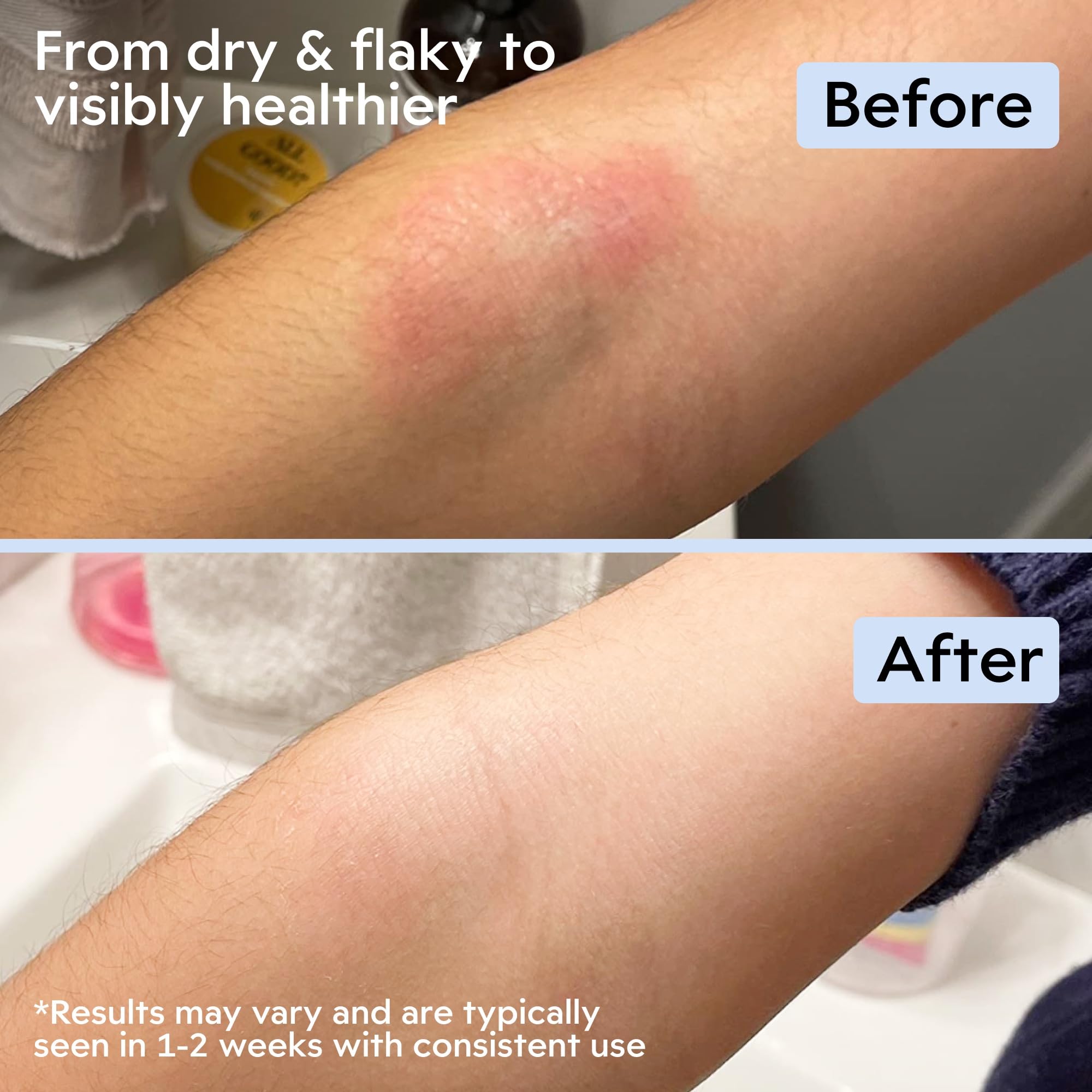 Application sur la main, crème Manuka Miel Avoine.