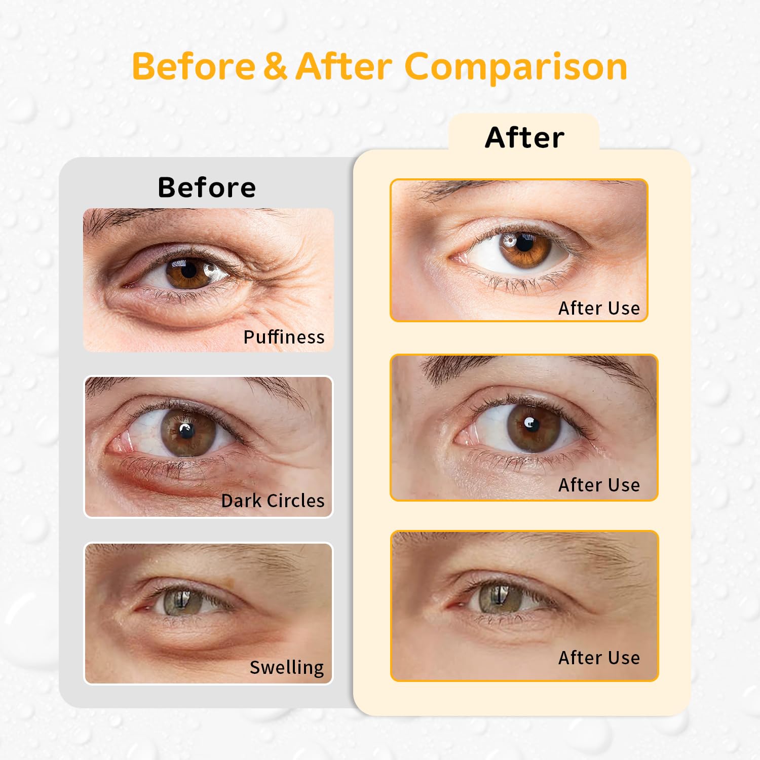 Conbella pads gel yeux réutilisables, douceur fraîche après exposition à l’écran.