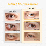 Conbella pads gel yeux réutilisables, douceur fraîche après exposition à l’écran.