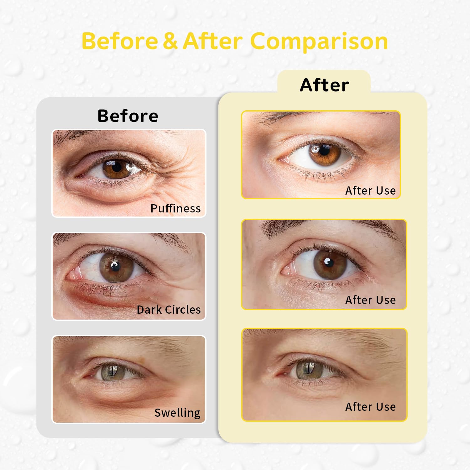 Conbella pads yeux gel réutilisables épousent les contours pour un confort durable.