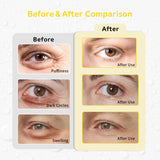 Conbella pads yeux gel réutilisables épousent les contours pour un confort durable.