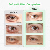 Patchs CONBELLA pour les yeux: adaptables et compacts pour le contour des yeux.