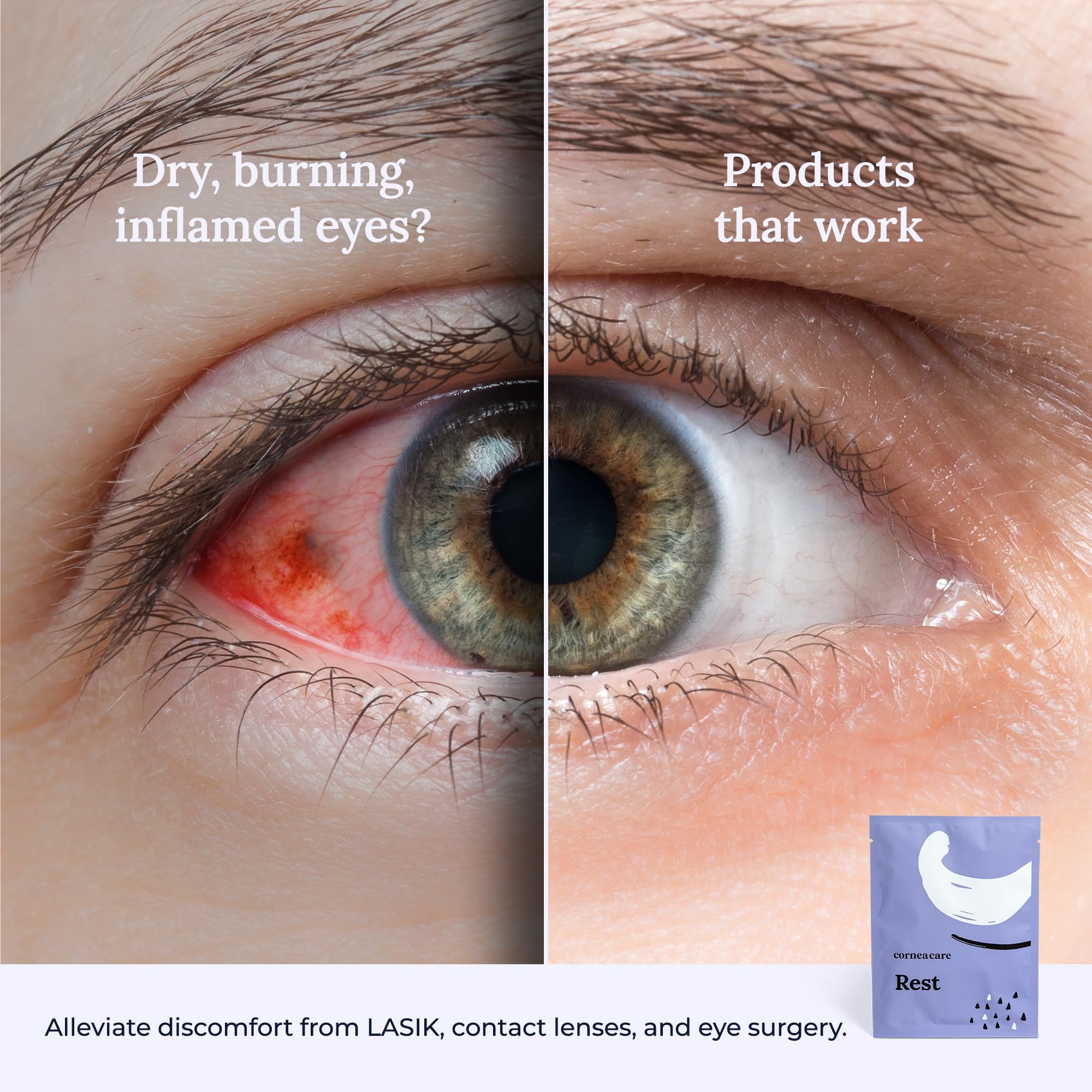 CorneaCare Rest posé sur les yeux, utilisation simple et détente rapide