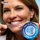 Avant/après sourire avec Crest Whitestrips Classic Vivid à domicile