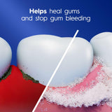 Effet anti-plaque autour des gencives avec Crest Pro-Health Gum Detoxify.