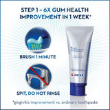 Avant/après dents plus blanches avec Crest Pro-Health