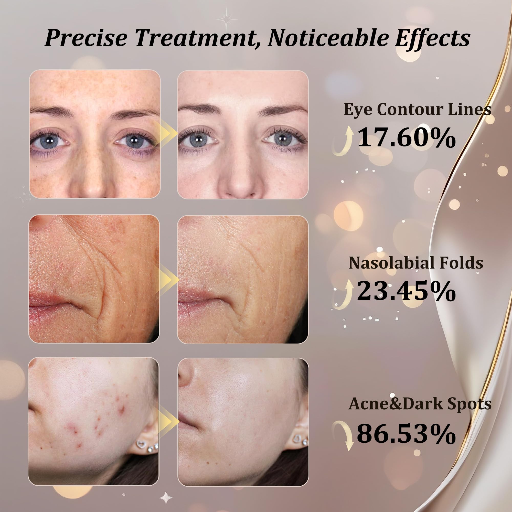 CUEME masque réglages tête réglables s'adapte facilement à tous les visages.